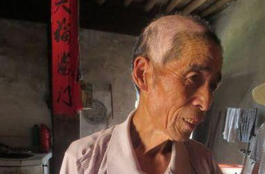 武汉北大白癜风医院医生介绍老年白癜风的危害