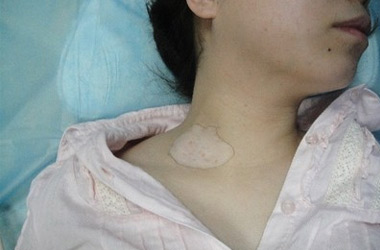 武汉北大白癜风医院告诉您女性易患白癜风和哪些原因有关？